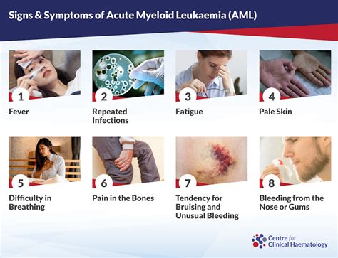 Acute Myeloid Leukemia (AML) Diagnosis .